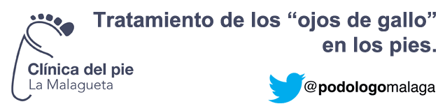 tratamiento del ojo de gallo en el pie - podologo malaga