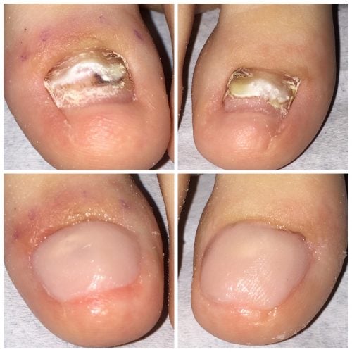 1532065070618 500x500 1