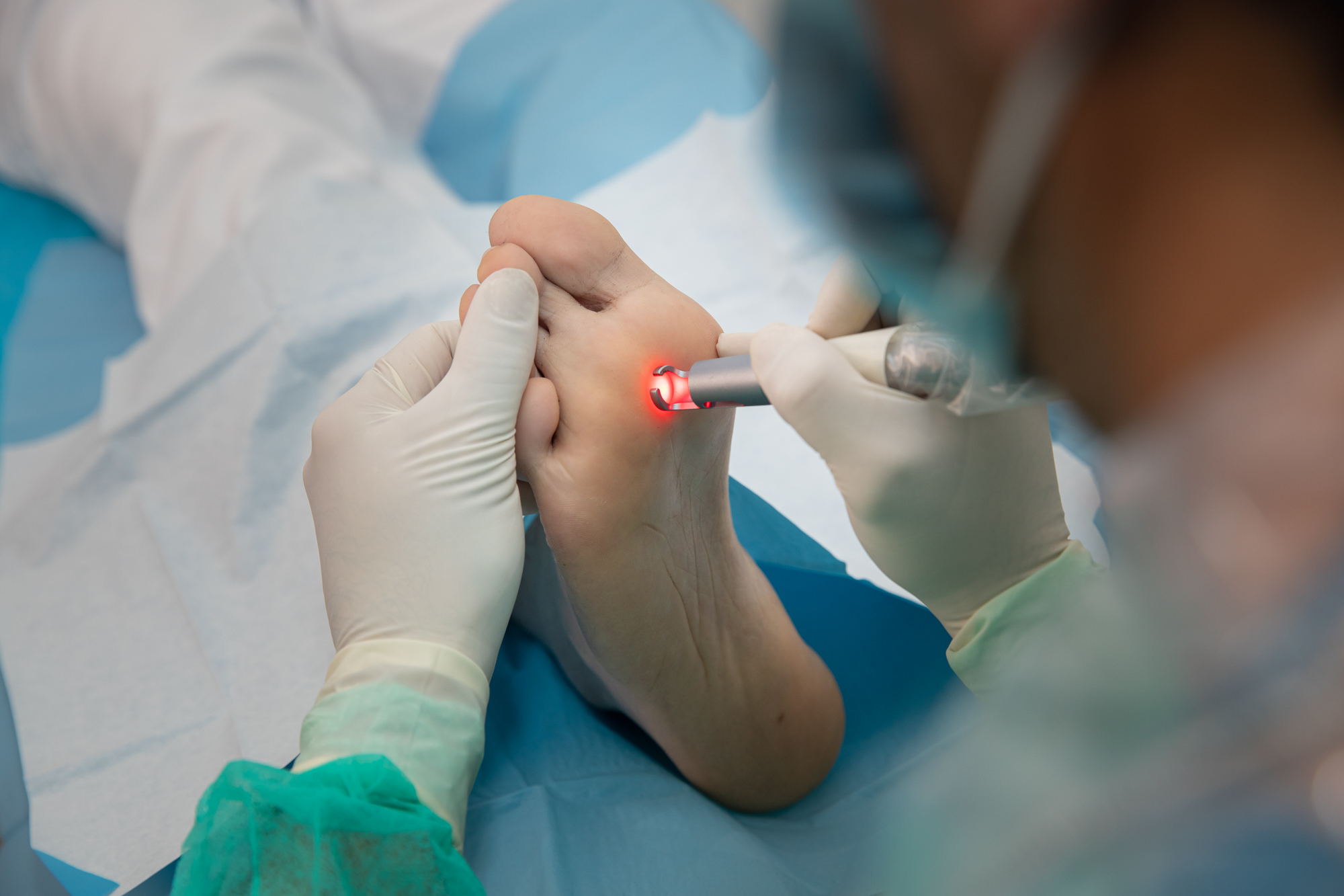 cirugia laser clinicadelpie 1