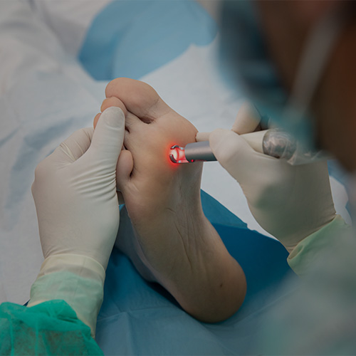 cirugia laser clinicadelpie