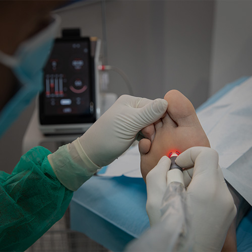 eliminar callo cronico clinicadelpie