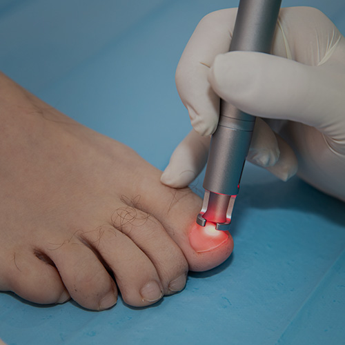 tratamiento una encarnada